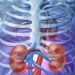 Deadly Link Between Chronic Kidney Disease and Heart Disease Revealed by New Research
