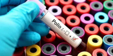 First Polio Case of the Year Reported in Sujawal, Four Year Old Child Affected