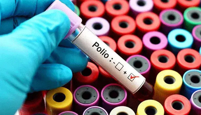 First Polio Case of the Year Reported in Sujawal, Four Year Old Child Affected